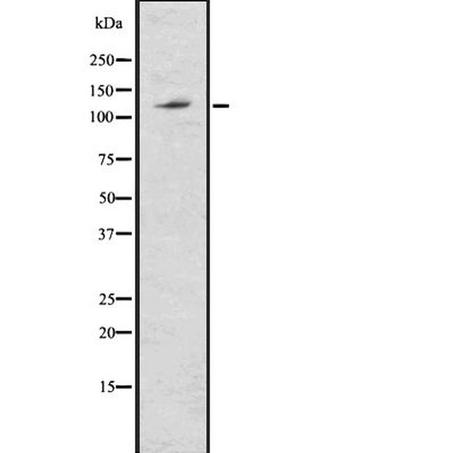 ABCG1 Antibody in Western Blot (WB)