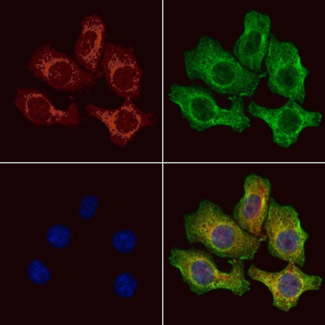 PRKD2 Antibody in Immunocytochemistry (ICC/IF)