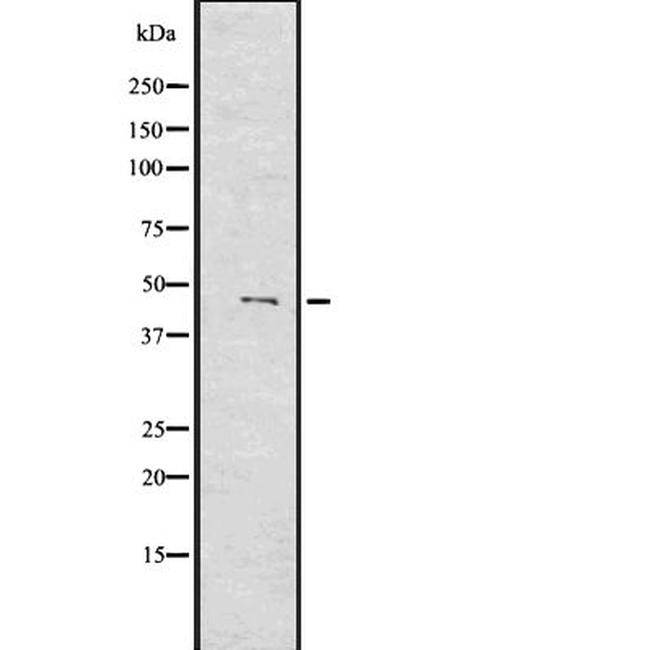 MYOD1 Antibody in Western Blot (WB)