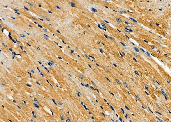 AMFR Antibody in Immunohistochemistry (Paraffin) (IHC (P))