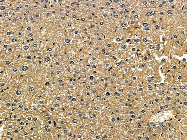 SRM Antibody in Immunohistochemistry (Paraffin) (IHC (P))