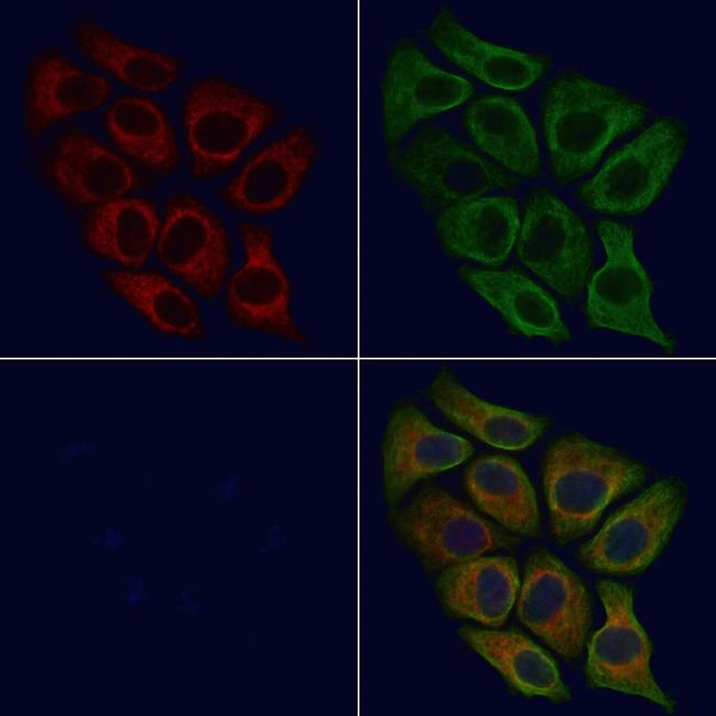 PPT1 Antibody in Immunocytochemistry (ICC/IF)