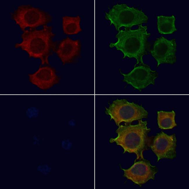 CENPE Antibody in Immunocytochemistry (ICC/IF)