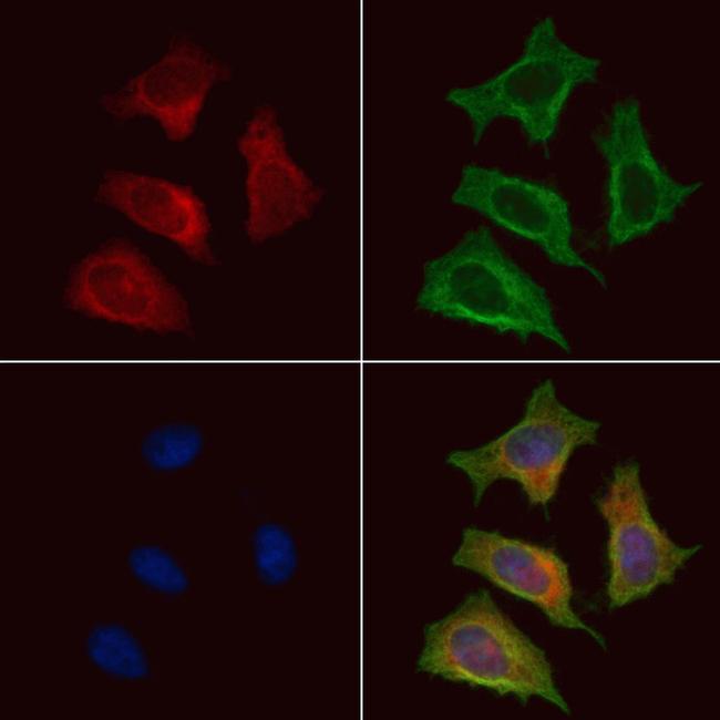 CD21 Antibody in Immunocytochemistry (ICC/IF)