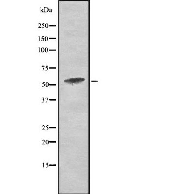 Phospho-PKM2 (Tyr105) Antibody in Western Blot (WB)