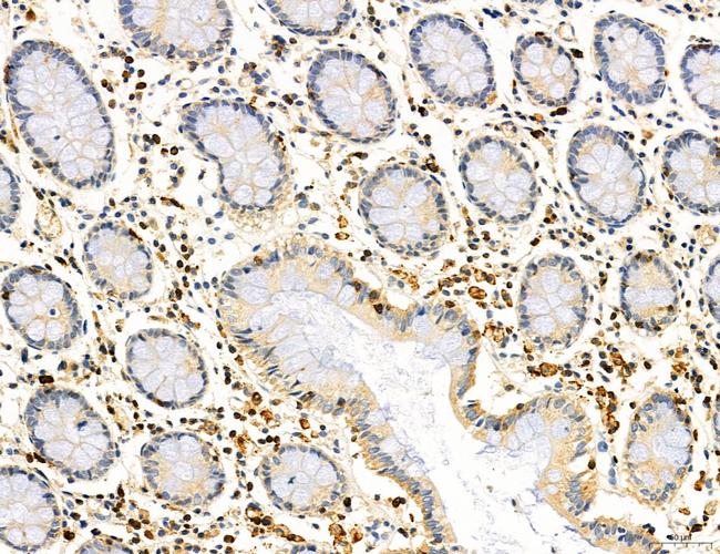 Phospho-PKM2 (Ser37) Antibody in Immunohistochemistry (Paraffin) (IHC (P))