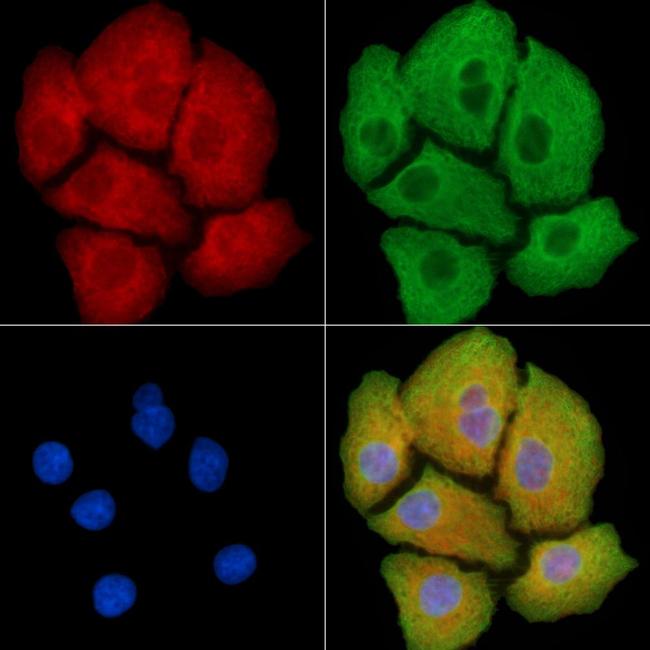 MYL12A Antibody in Immunocytochemistry (ICC/IF)