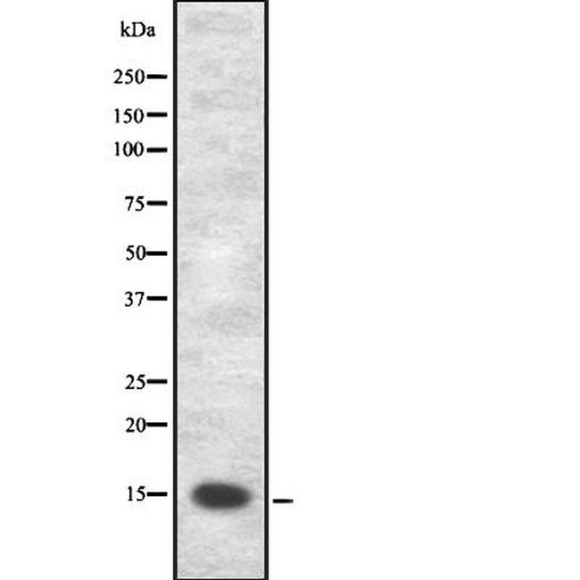 VAMP8 Antibody in Western Blot (WB)