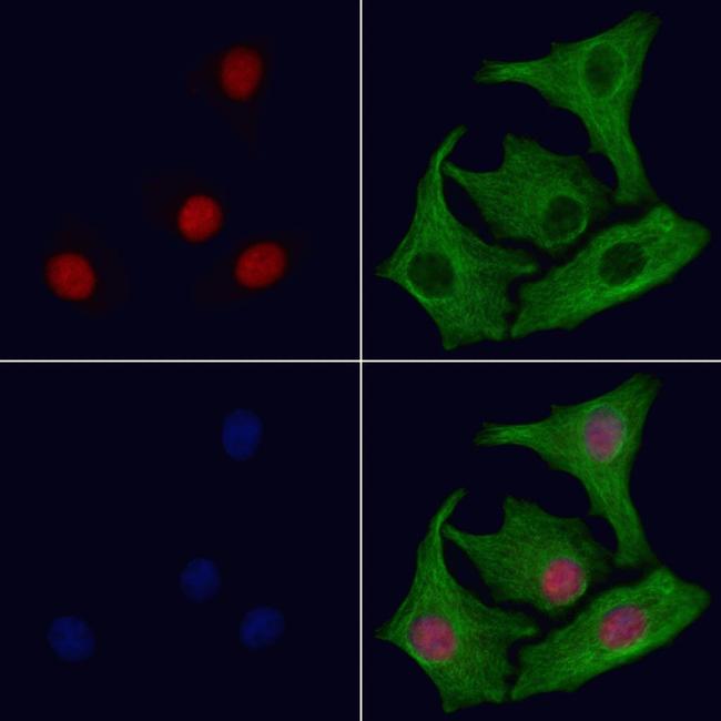 PABPN1 Antibody in Immunocytochemistry (ICC/IF)