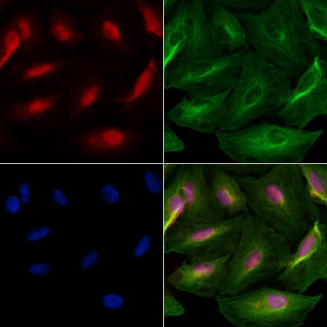 Cdc6 Antibody in Immunocytochemistry (ICC/IF)