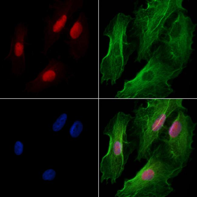 CTNNBL1 Antibody in Immunocytochemistry (ICC/IF)