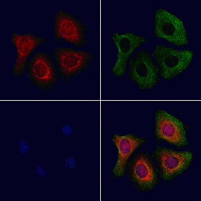 AP2S1 Antibody in Immunocytochemistry (ICC/IF)