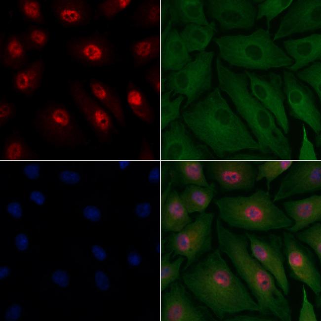 HIPK2 Antibody in Immunocytochemistry (ICC/IF)