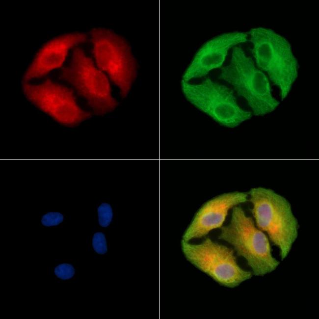 alpha Actinin 3 Antibody in Immunocytochemistry (ICC/IF)