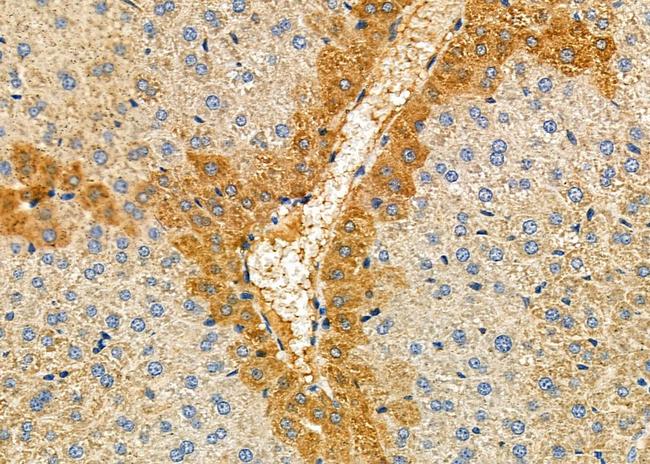 TRIM29 Antibody in Immunohistochemistry (Paraffin) (IHC (P))