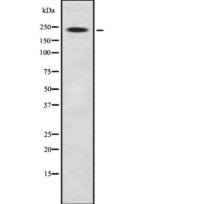 Tenascin C Antibody in Western Blot (WB)