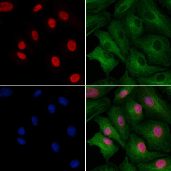 EN1 Antibody in Immunocytochemistry (ICC/IF)