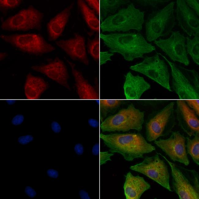 ATG4A Antibody in Immunocytochemistry (ICC/IF)