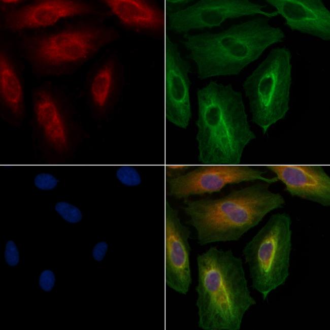 TRIP10 Antibody in Immunocytochemistry (ICC/IF)