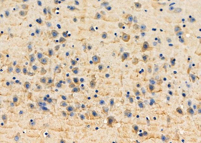 CLEC3B Antibody in Immunohistochemistry (Paraffin) (IHC (P))