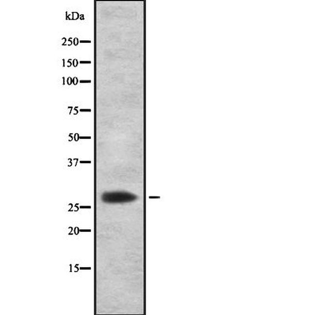 CITED2 Antibody in Western Blot (WB)