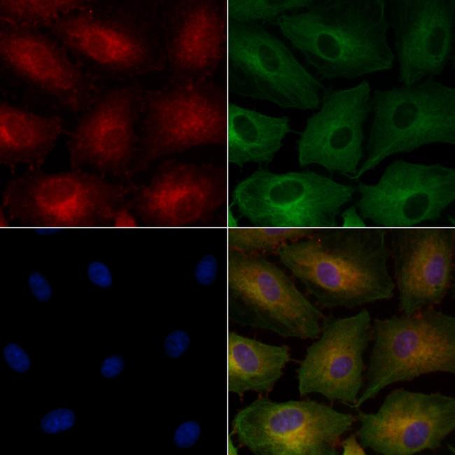 Renalase Antibody in Immunocytochemistry (ICC/IF)