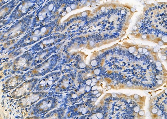 SEP15 Antibody in Immunohistochemistry (Paraffin) (IHC (P))