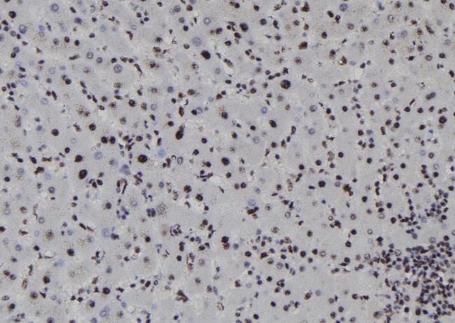 SOX1 Antibody in Immunohistochemistry (Paraffin) (IHC (P))