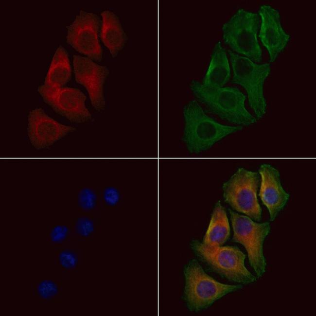 p39 Antibody in Immunocytochemistry (ICC/IF)