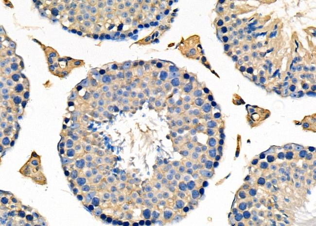 UGGT1 Antibody in Immunohistochemistry (Paraffin) (IHC (P))