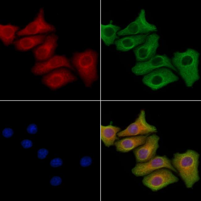 URM1 Antibody in Immunocytochemistry (ICC/IF)