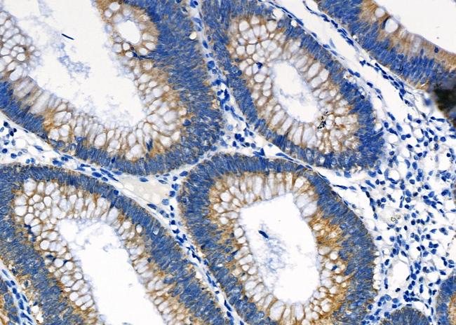 TSPO Antibody in Immunohistochemistry (Paraffin) (IHC (P))