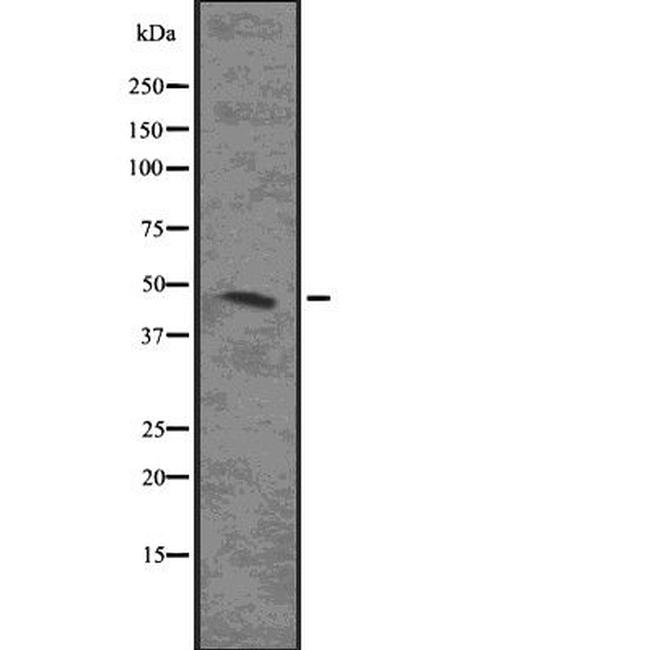 MAPKAPK2 Antibody in Western Blot (WB)