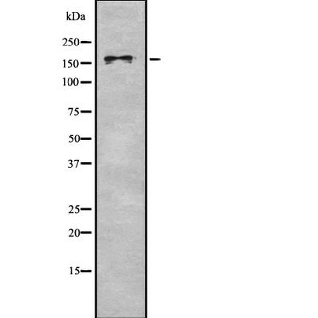 BAZ1B Antibody in Western Blot (WB)