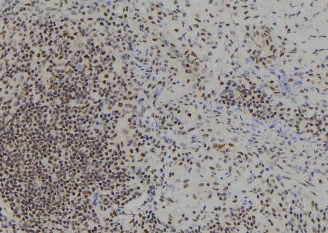 BACH1 Antibody in Immunohistochemistry (Paraffin) (IHC (P))