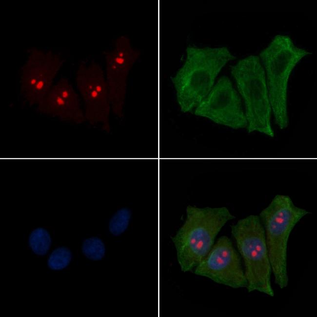 FUS Antibody in Immunocytochemistry (ICC/IF)