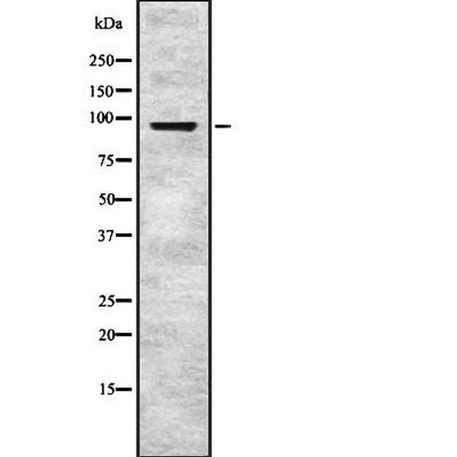 EPS8 Antibody in Western Blot (WB)