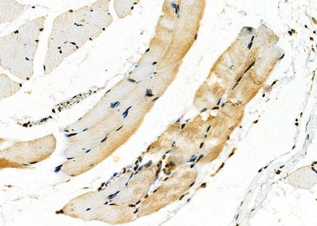 MYH2 Antibody in Immunohistochemistry (Paraffin) (IHC (P))