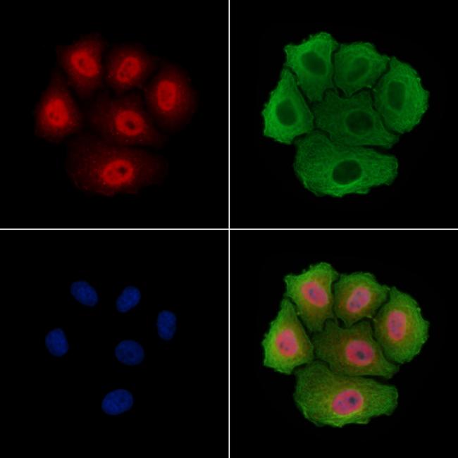 THOC5 Antibody in Immunocytochemistry (ICC/IF)