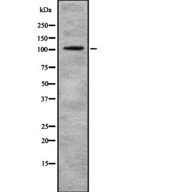 eIF3b Antibody in Western Blot (WB)