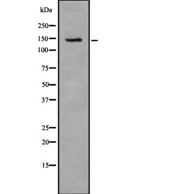 TAT Antibody in Western Blot (WB)