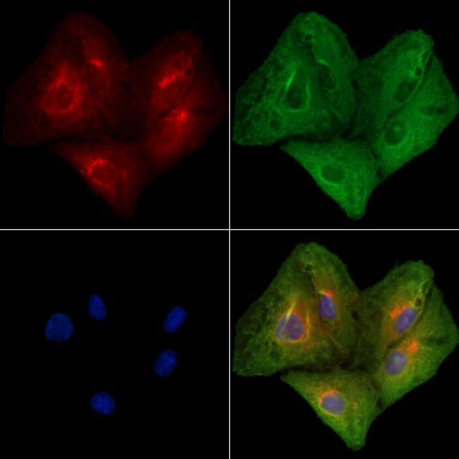 ATP7A Antibody in Immunocytochemistry (ICC/IF)