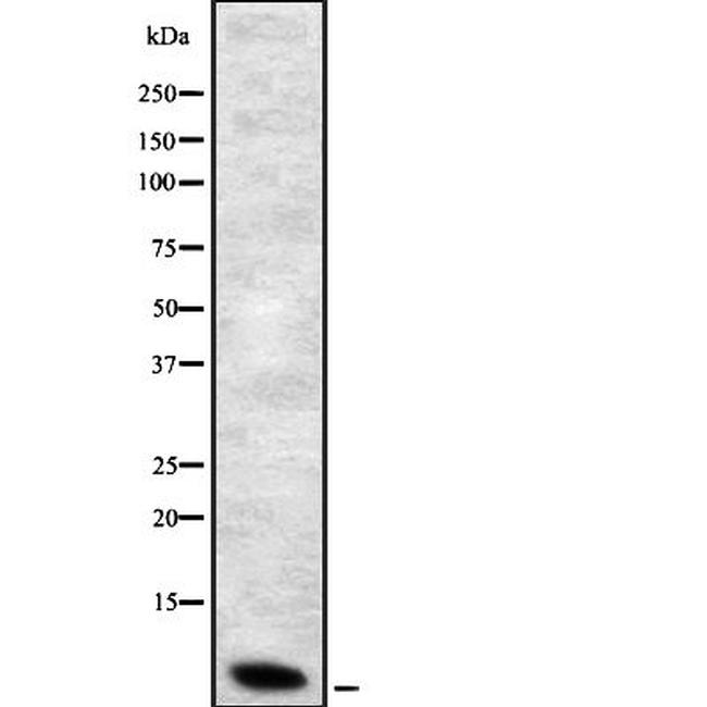 DEFB1 Antibody in Western Blot (WB)