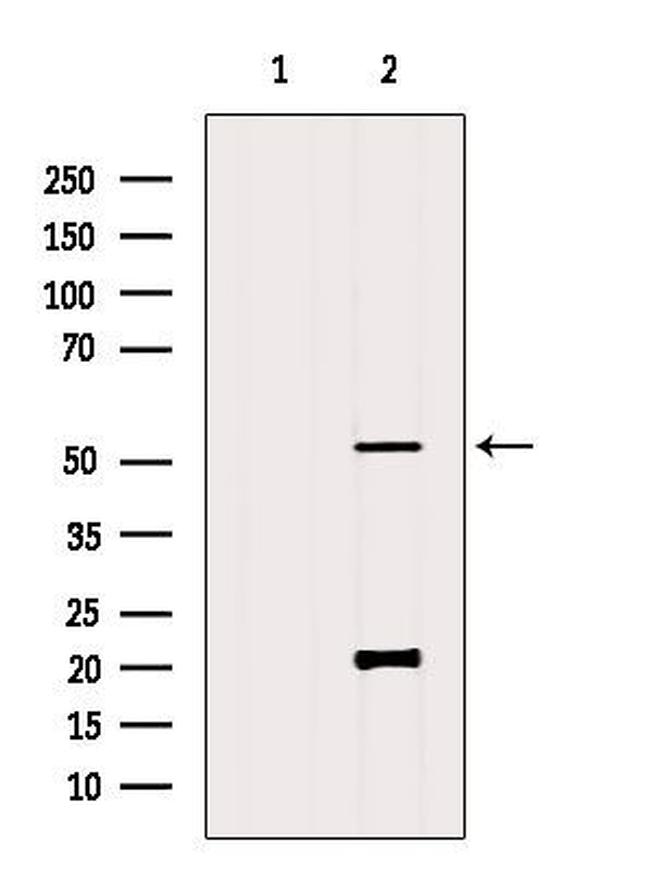 FUT4 Antibody in Western Blot (WB)