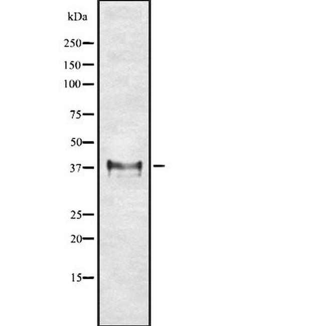 HLA-G Antibody in Western Blot (WB)