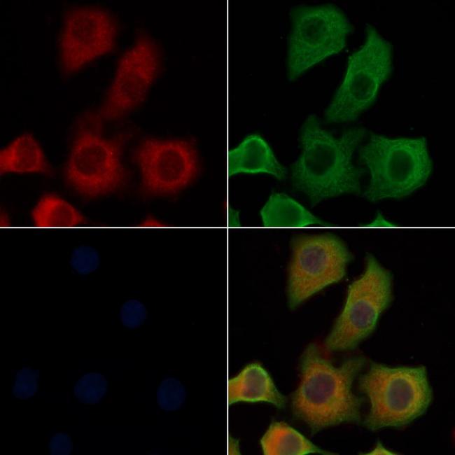 IL4R Antibody in Immunocytochemistry (ICC/IF)