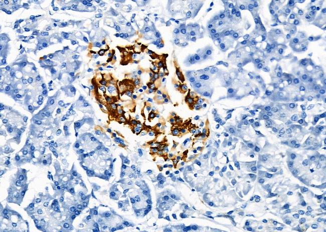 KCNMA1 Antibody in Immunohistochemistry (Paraffin) (IHC (P))