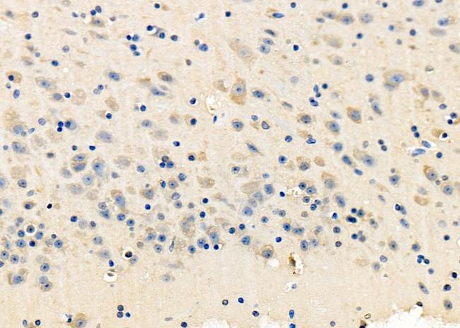 NMDAR2C Antibody in Immunohistochemistry (Paraffin) (IHC (P))