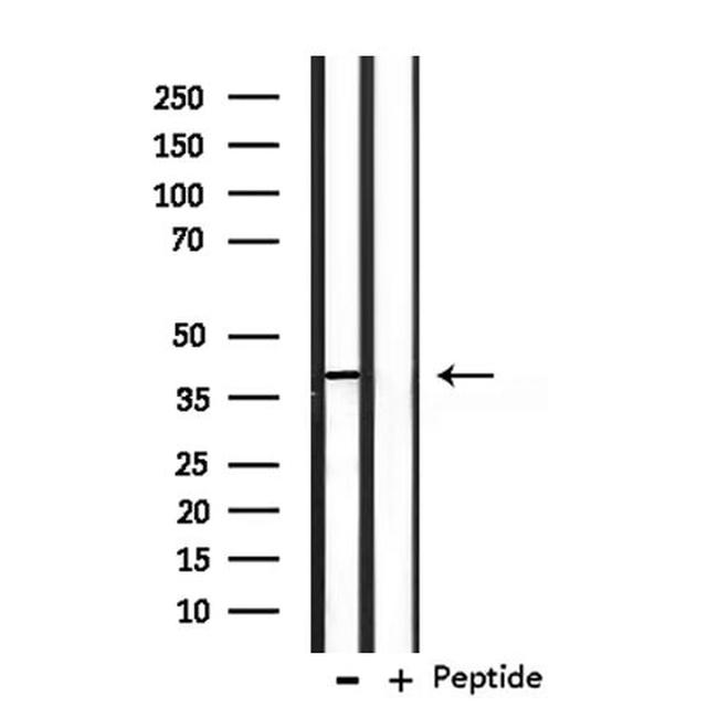 OPCML Antibody in Western Blot (WB)