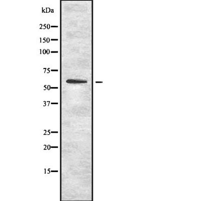 OCT1 Antibody in Western Blot (WB)